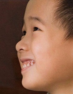 Special education, special needs